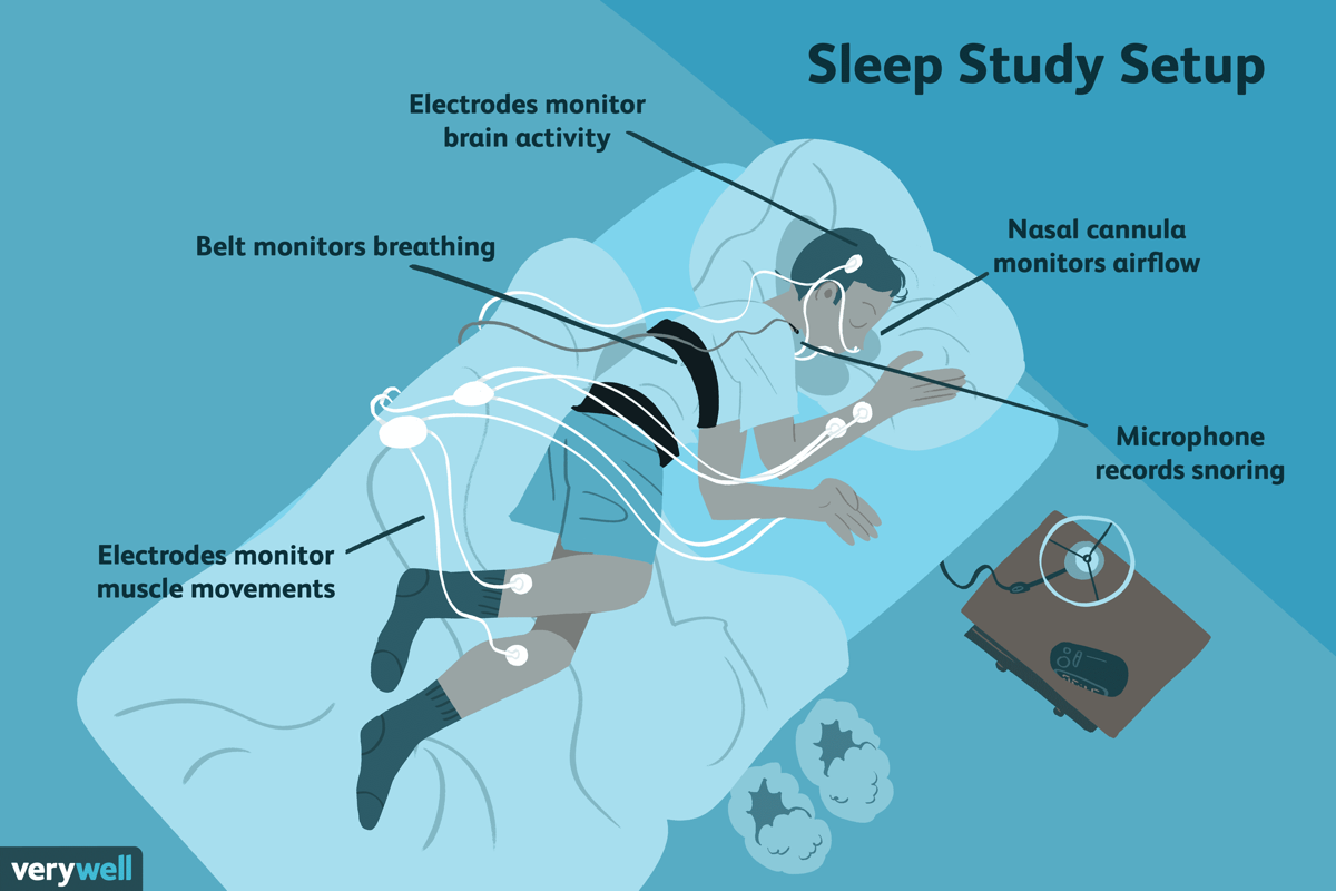 Sleep study