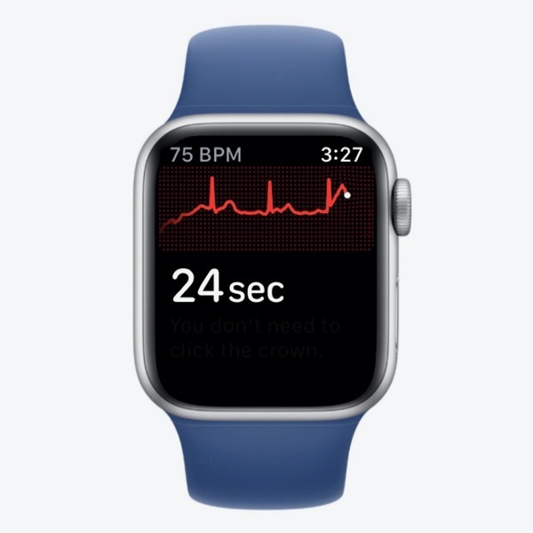 #title# ECG in Progress